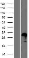 ZFAND1 Protein (Over-Expression Lysate Myc-DDK (Flag))
