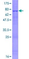 Human FBXL16 Protein (Recombinant GST)