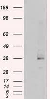 IHC-plus™ SRR / Serine Racemase Antibody (clone 9E8)