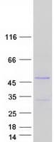 Human ZFYVE27 / Protrudin Protein (Recombinant Myc-DDK (Flag))