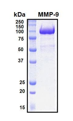 Human MMP9 / Gelatinase B Protein (Recombinant His, N-Terminal)