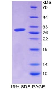 Bovine CTGF Protein (Recombinant His-T7)
