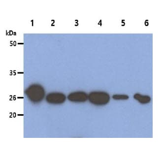 PRDX6 / Peroxiredoxin 6 Antibody (clone AT22E7)
