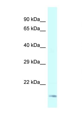 Polyclonal Rabbit anti-Human GEMIN6 / Gemin-6 Antibody (aa62-111, WB)