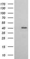 ACAA2 Antibody (clone OTI2H2)