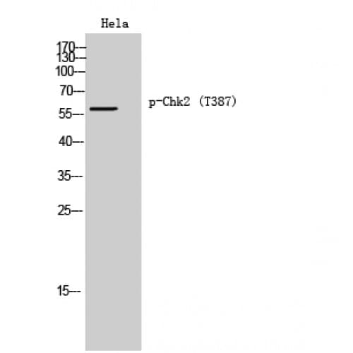 CHEK2 / CHK2 Antibody (330-410 aa)