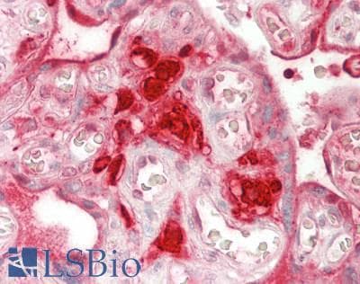PathPlus™ Polyclonal Goat anti-Human Alpha-1-Antichymotrypsin Antibody (IHC, WB)
