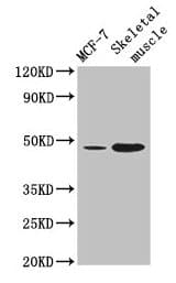 Polyclonal Rabbit anti-Human ARRDC3 Antibody