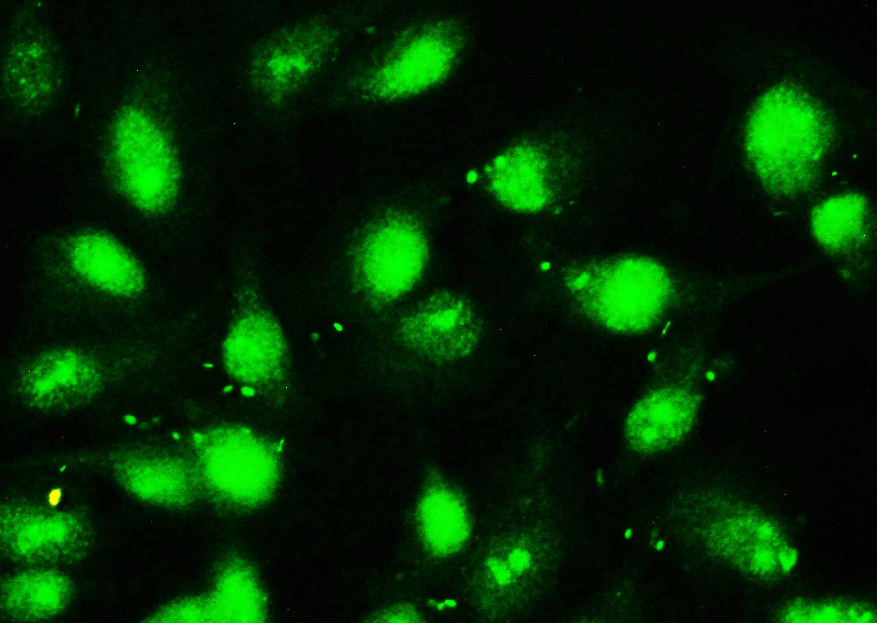 METTL3 Antibody