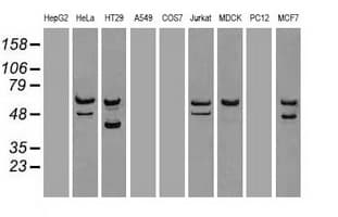 CHEK2 / CHK2 Antibody (clone OTI4C10)