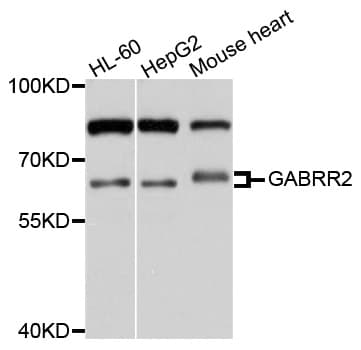 Polyclonal Rabbit anti-Human GABRR2 Antibody (WB)