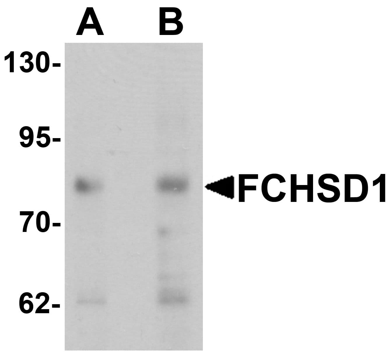 IHC-plus™ FCHSD1 Antibody