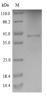 Human CYBB / NOX2 / gp91phox Protein (Recombinant 6His, N-terminus)