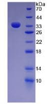 Human FN1 / Fibronectin Protein (Recombinant His)