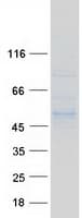Human POGLUT1 Protein (Recombinant Myc-DDK (Flag))