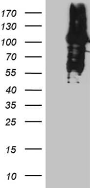 MLH1 Antibody (aa1-298, clone OTI2A8)