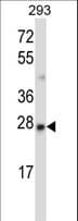 Polyclonal Rabbit anti-Human MBD3 Antibody (aa1-30, WB)