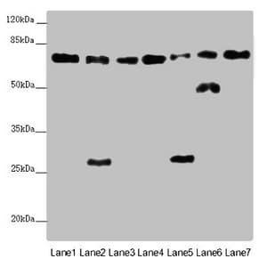 ALB / Serum Albumin Antibody