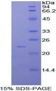 Mouse NME6 Protein (Recombinant His)