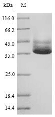 Salmonella typhimurium mglB Protein (Recombinant 6His, N-terminus)