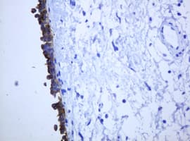 KRT5 / CK5 / Cytokeratin 5 Antibody (aa1-273, clone OTI1E7)