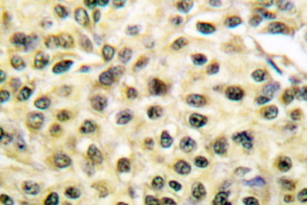 MCM2 Antibody (Ala11)