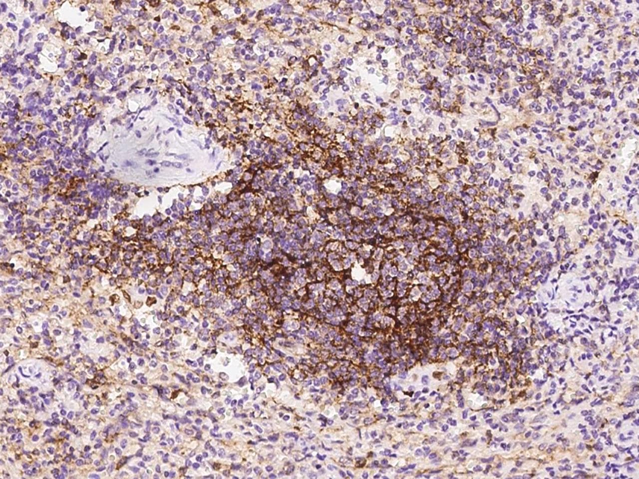 Polyclonal Rabbit anti-Human CR1 / CD35 Antibody (IHC)