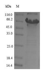 Human CYP11B2 / Aldosterone Synthase Protein (Recombinant 6His-SUMO, N-terminus)