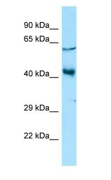 YY2 Antibody (aa222-271)