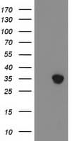 ZFP36 / Tristetraprolin Antibody (clone OTI1C8)