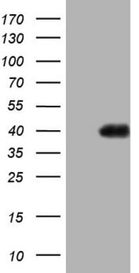 Monoclonal Mouse anti-Human PAGE1 Antibody (clone OTI13B1, WB)