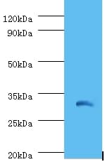IL-1B / IL-1 Beta Antibody (HRP)