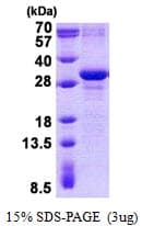 Human MXD3 / MAD3 Protein (Recombinant His)