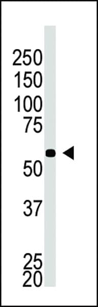 BACE2 Antibody (aa310-339)
