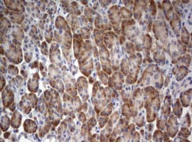 STK11 / LKB1 Antibody (aa1-236, clone OTI0A3)