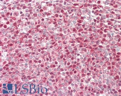 IHC-plus™ RECQ1 / RECQL Antibody (aa1-50)