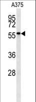 NAB2 Antibody (aa109-138)