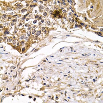 Polyclonal Rabbit anti-Human ARRB2 / Beta Arrestin 2 Antibody (IHC, IF, WB)