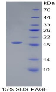 Mouse IL18 Protein (Recombinant His)