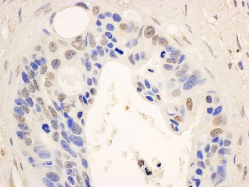Polyclonal Rabbit anti-Human STAT6 Antibody (aa600-650, IHC, WB)