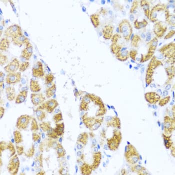 MOK / RAGE Antibody