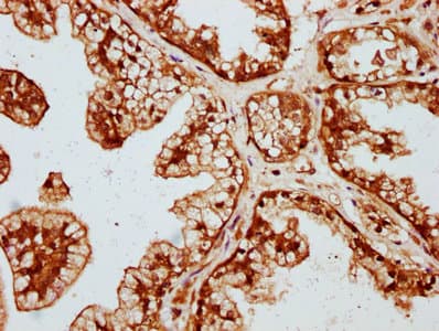 DVL2 / Dishevelled 2 Antibody (aa1-240)