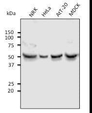 IHC-plus™ TUBA4A / TUBA1 Antibody (N-Terminus)
