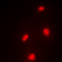 MTF2 / PCL2 Antibody