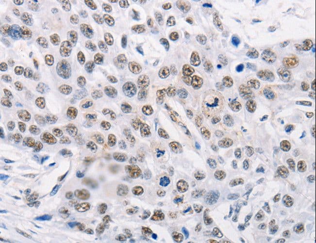 Polyclonal Rabbit anti-Human MURF1 / IRF Antibody (IHC, WB)