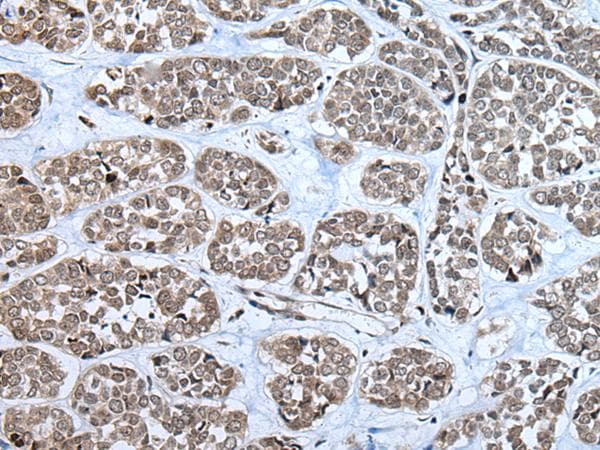 RPF2 / BXDC1 Antibody
