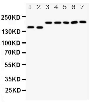 Polyclonal Rabbit anti-Human DCC Antibody (aa162-178, IHC, WB)