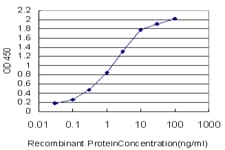 IHC-plus™ SNRPA / U1A Antibody (clone 3F9-1F7)
