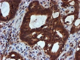 HARS2 Antibody (clone OTI5H2)