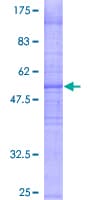 Human PKD2L1 Protein (Recombinant GST)